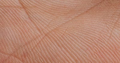 Guarding your skin barrier